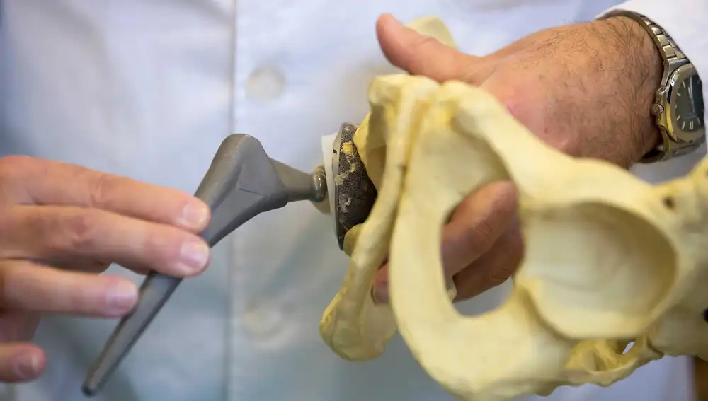 A nivel particular, el doctor Rafael Llopis calcula que, a lo largo de su carrera, habrá implantado más de 5.000 prótesis en caderas y rodillas