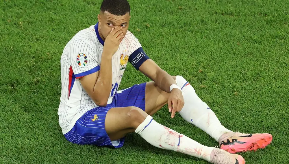 Mbappé se rompió la nariz durante un partido de la Eurocopa 2024