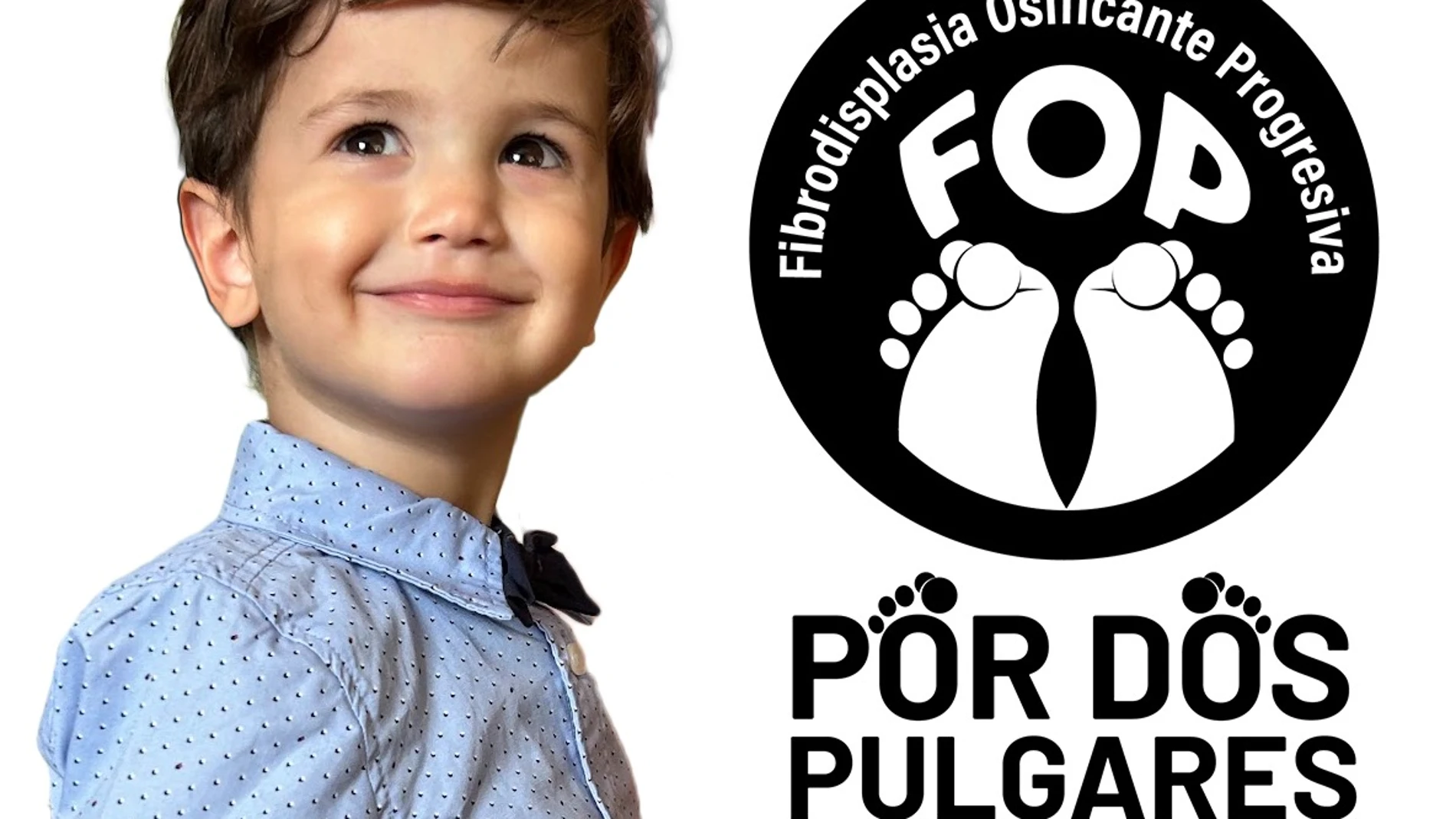 Festival benéfico en León para apoyar al pequeño Darío