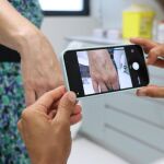 El melanoma es el tercer cáncer de piel más frecuente y el más agresivo
