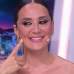 Tamara Falcó enseña las marcas de su cara en "El Hormiguero"
