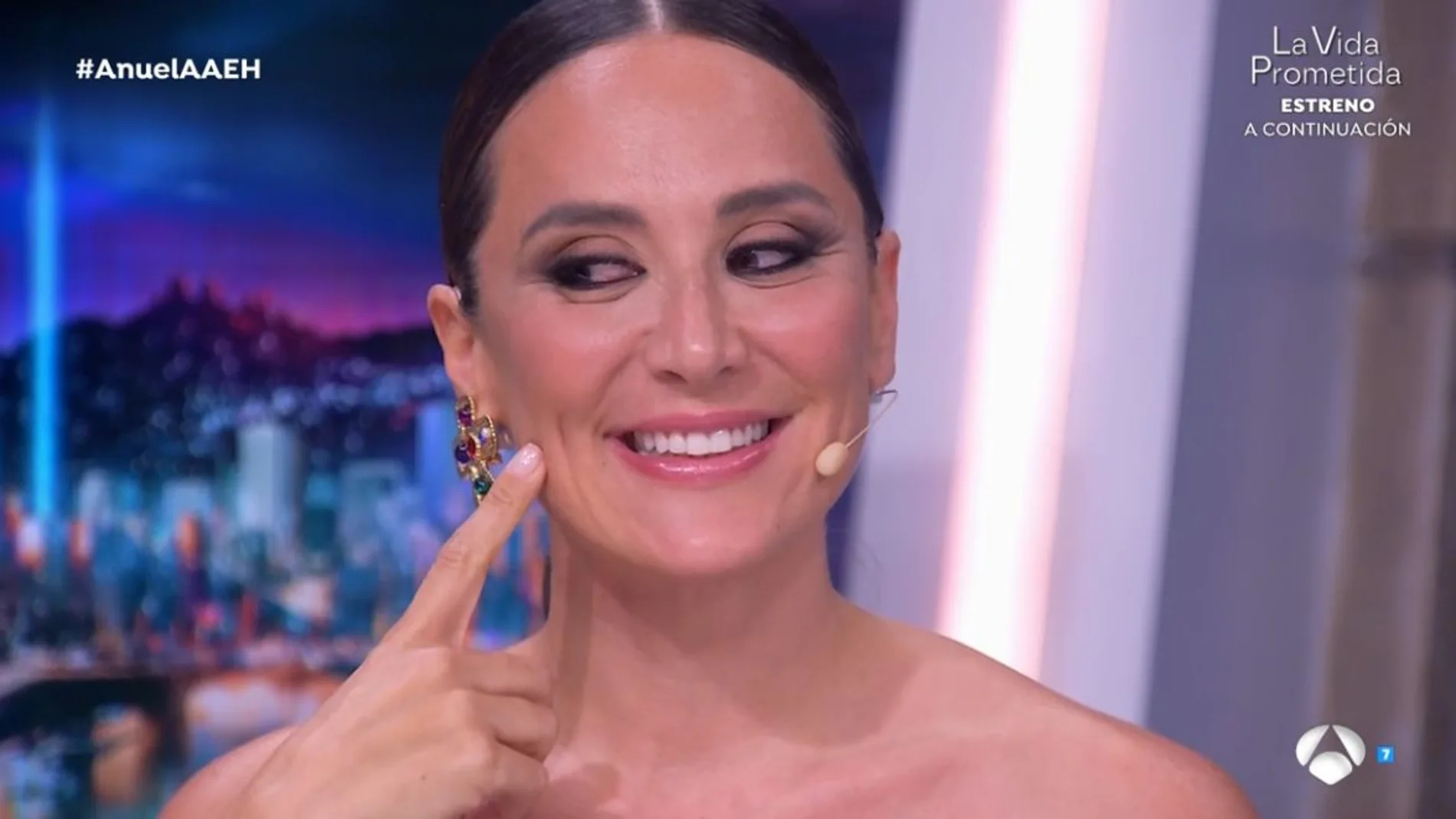 Tamara Falcó enseña las marcas de su cara en "El Hormiguero"