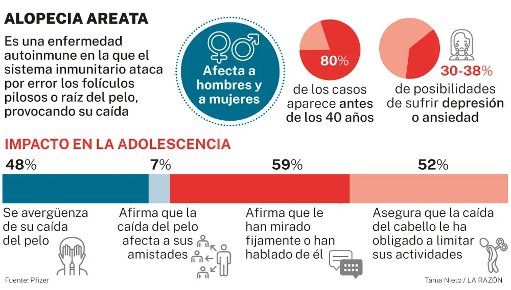 Alopecia areata