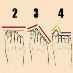 Tipos de pies