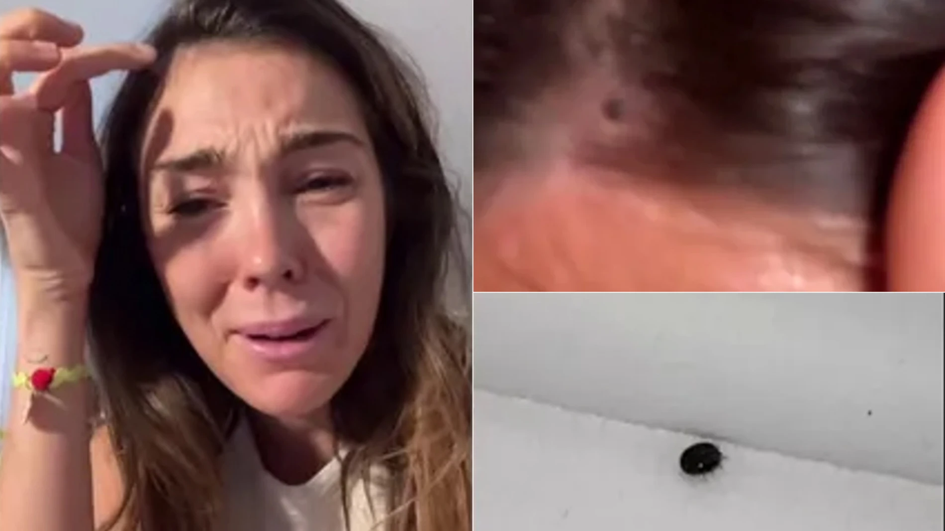 Anna Ferrer Padilla y la garrapata que le picó