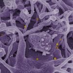 Virus Congo