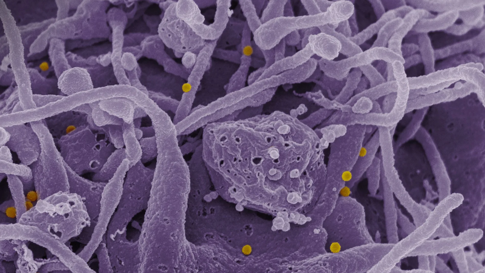 Virus Congo