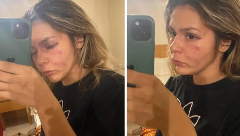Así quedó el rostros de Tamara Cruz