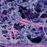 Una imagen microscópica del nuevo biomaterial. Las nanofibras son rosas; el ácido hialurónico se muestra en morado.