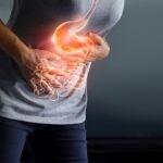 Cáncer gástrico