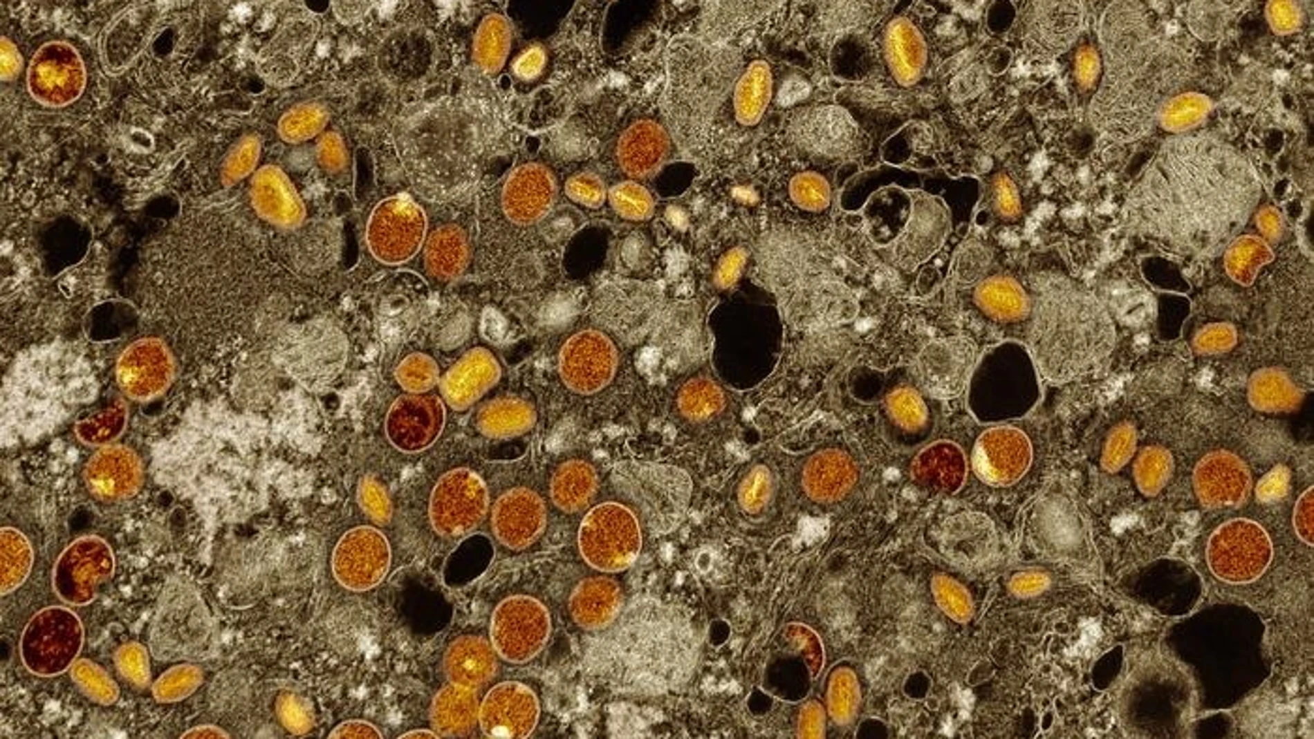 Imagen de partículas del virus mpox (rojo/amarillo). NIAD 16/08/2024