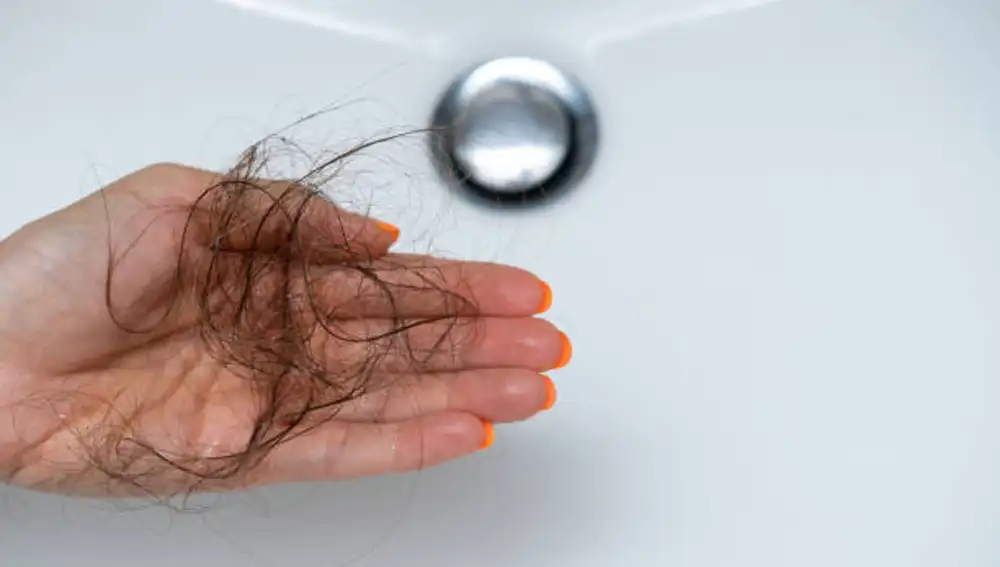 Pérdida de cabello