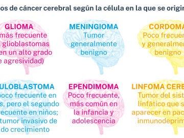 C&aacute;ncer cerebral