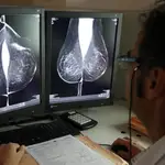 Estudio de una mamografía en el servicio del Hospital Río Hortega de Valladolid