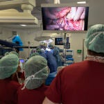 Trasplante de cara pionero en el hospital Bellvitge