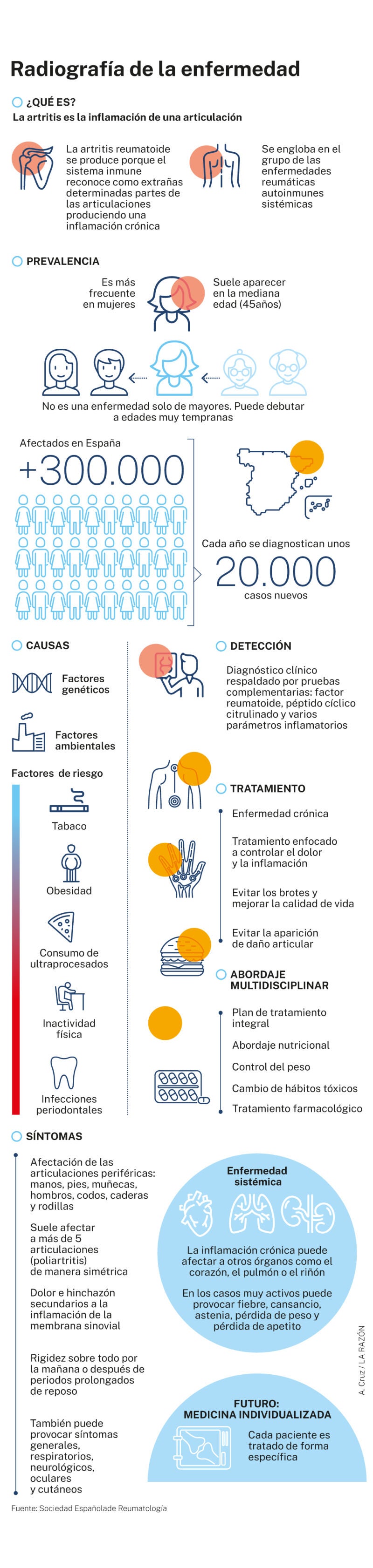Radiografía de la artritis