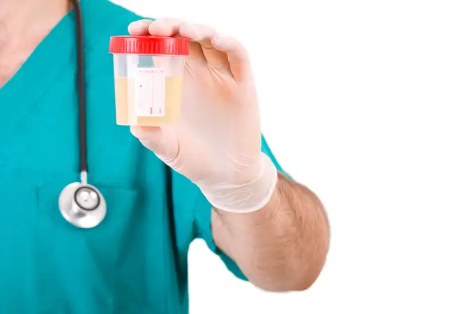 ¿Cómo prevenir las infecciones de orina? ¿Cómo prevenir las infecciones de orina?