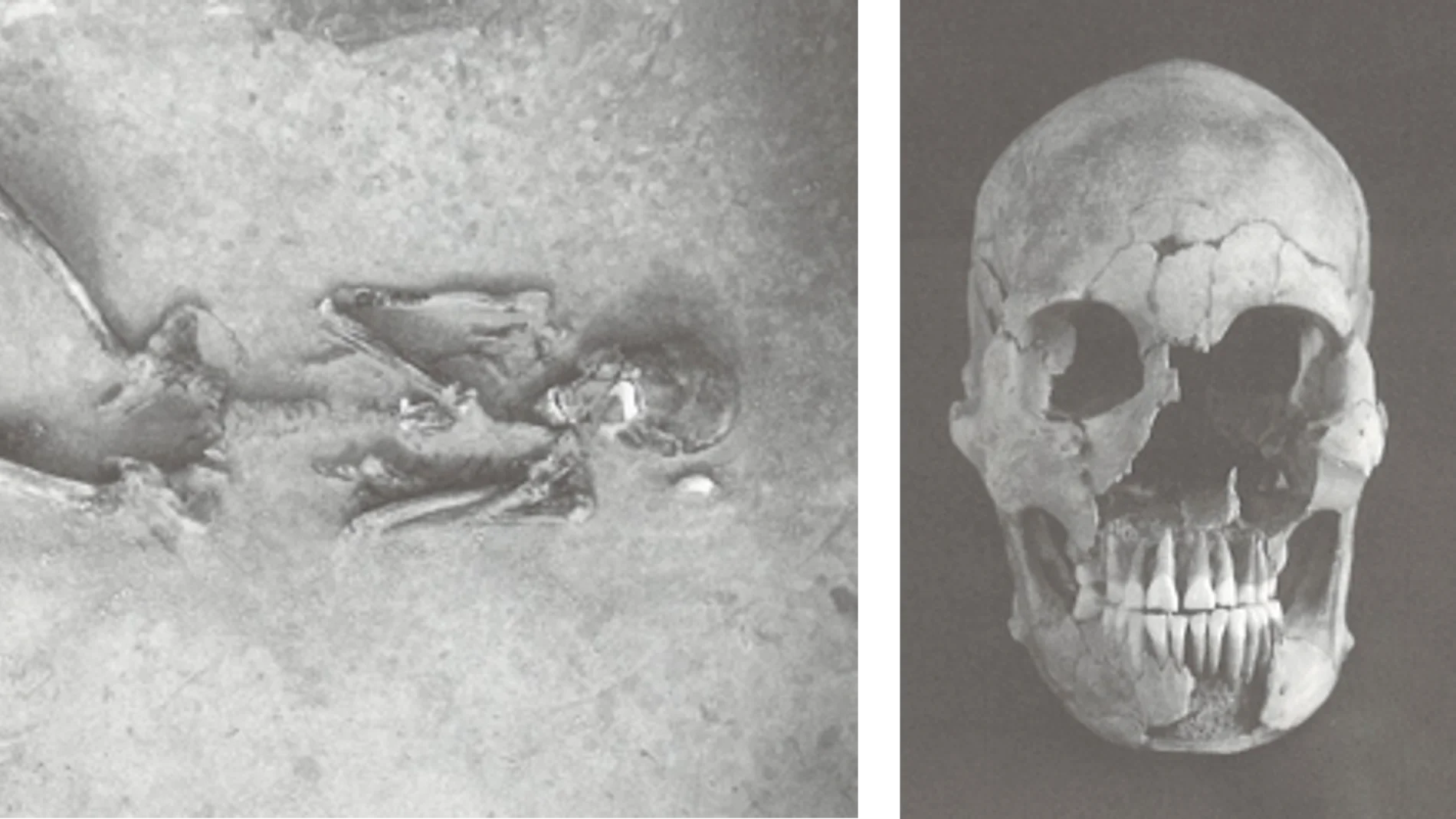 Restos humanos del período Yayoi, de aproximadamente 2,300 años atrás, de los cuales se extrajo ADN.
