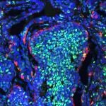 Los linfocitos T CD4 pueden jugar un papel crucial en la lucha contra el cáncer