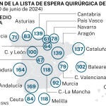 Esperas quirúrgicas en las ccaa