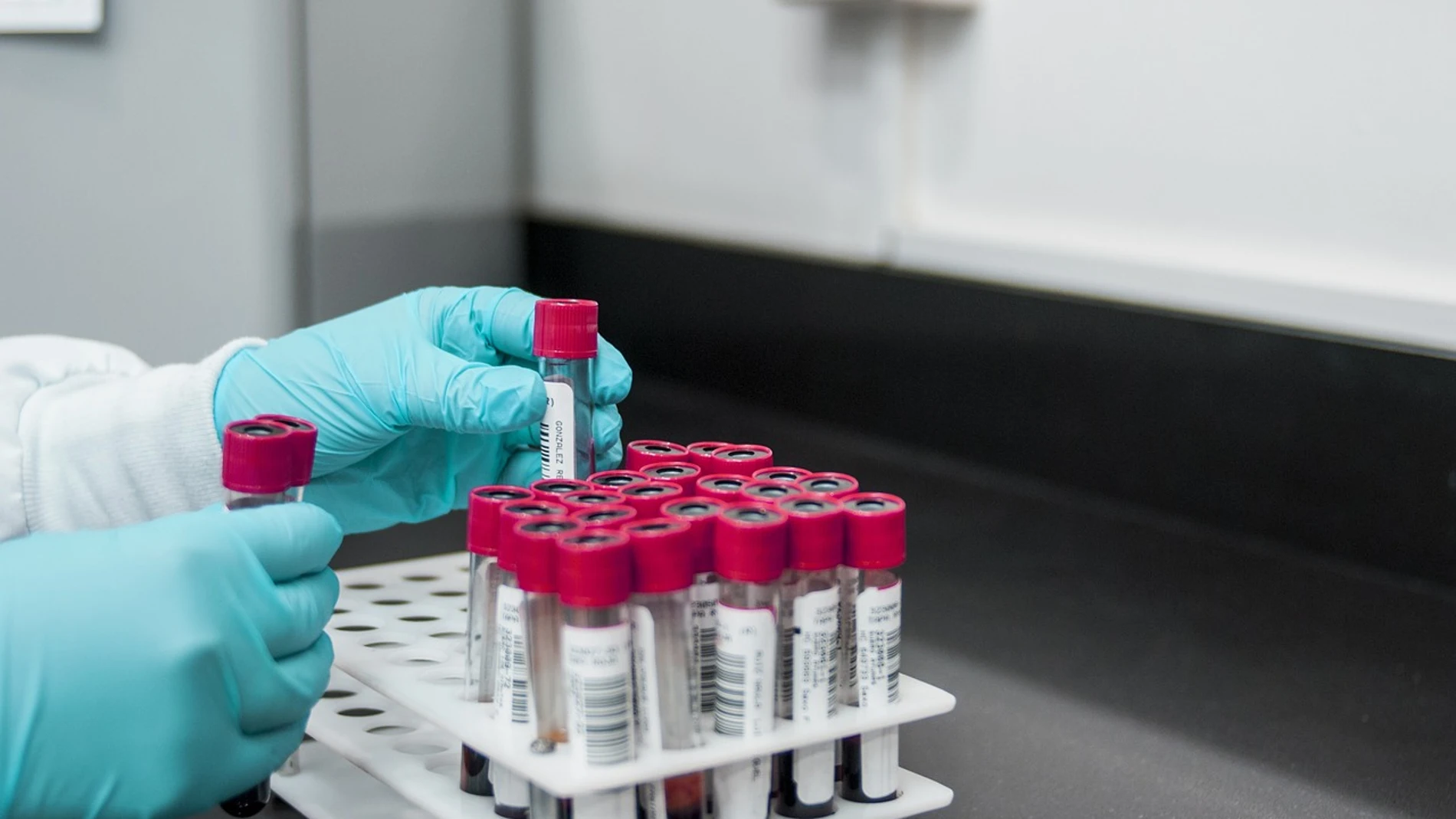 Una científica opina acerca de la inversión que hace el Gobierno de España para investigar el cáncer de mama