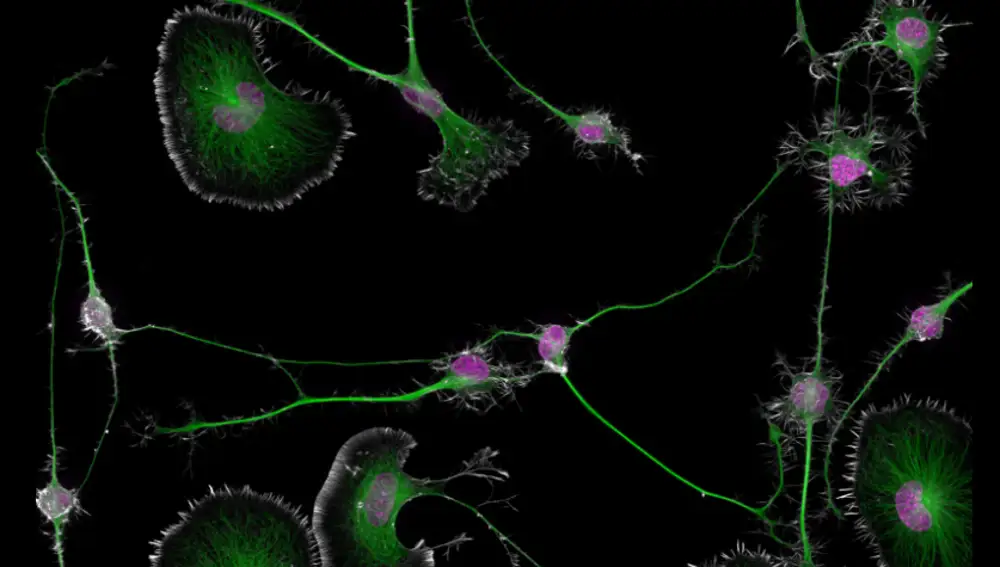 Celulas tumorales en el cerebro de un ratón