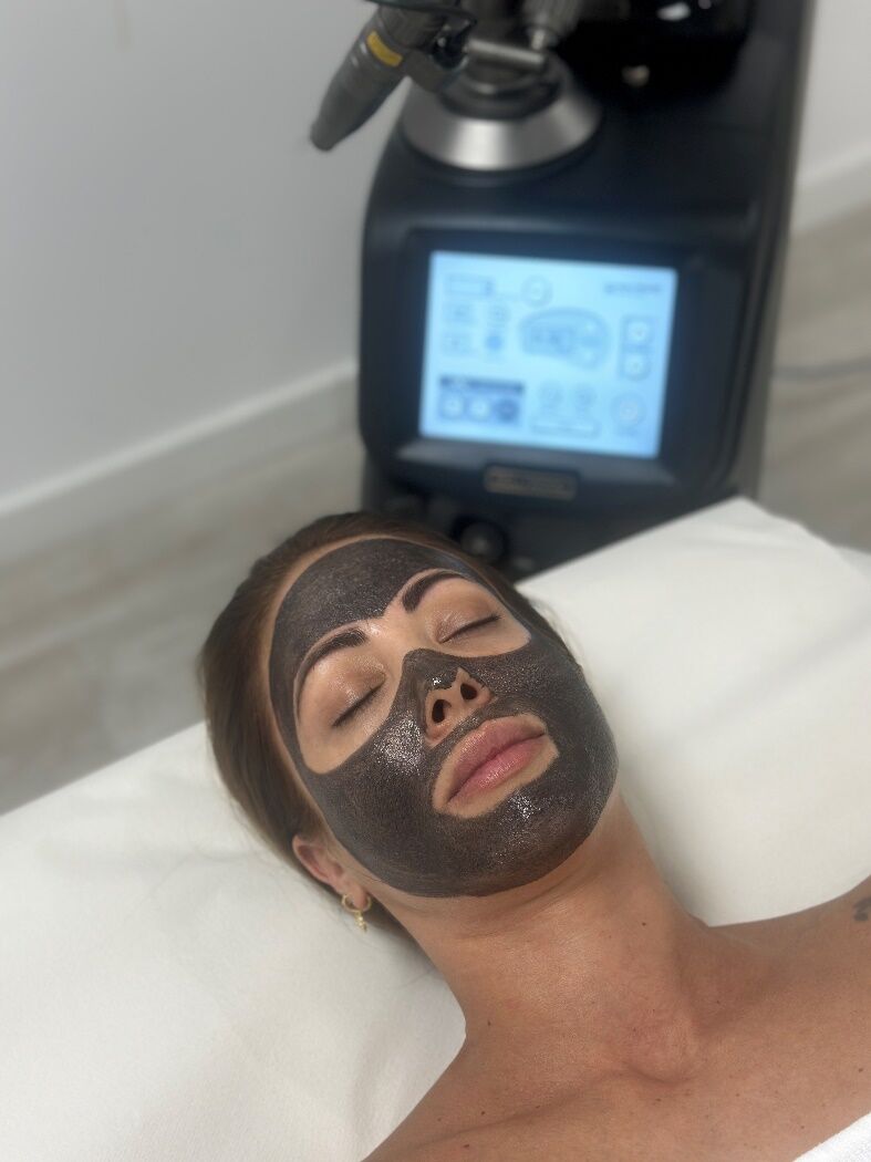 Hollywood peel