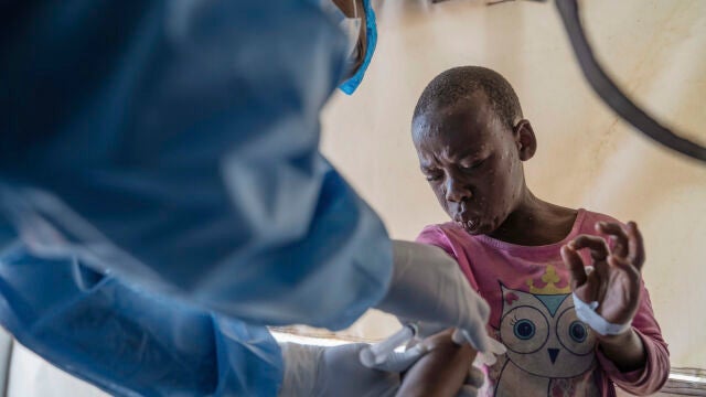 Mpox en África