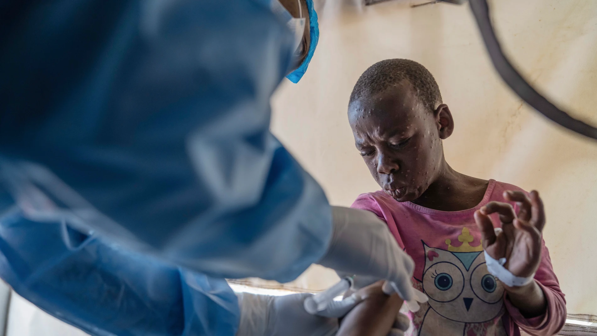 Un trabajador sanitario administra una vacuna contra la mpox a un menor en Congo