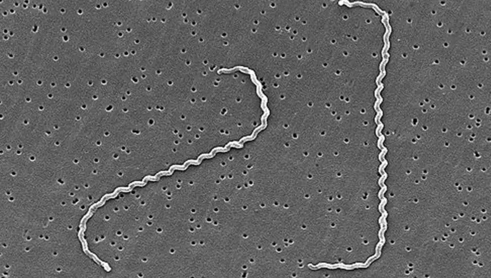 Bacteria leptospira