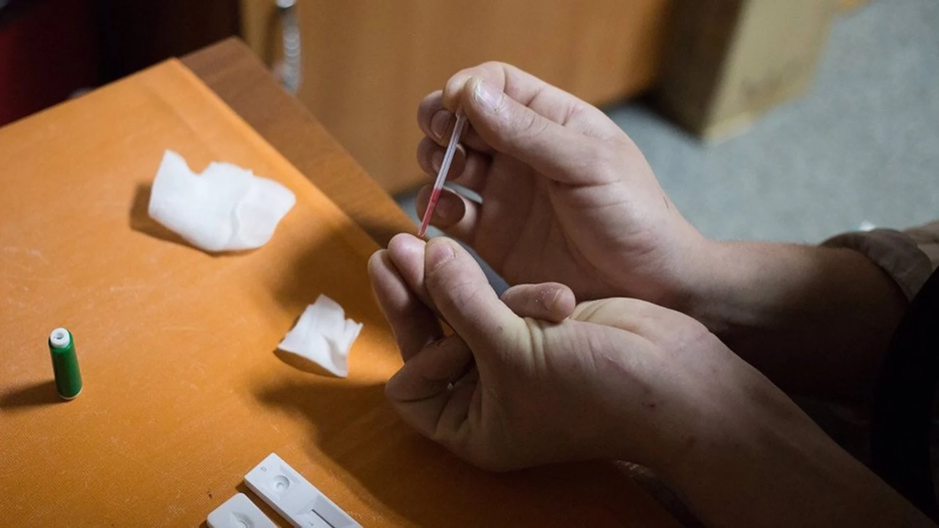MURCIA.-Aumenta un 13,8% el número de casos de infección por VIH en la Región de Murcia en 2023