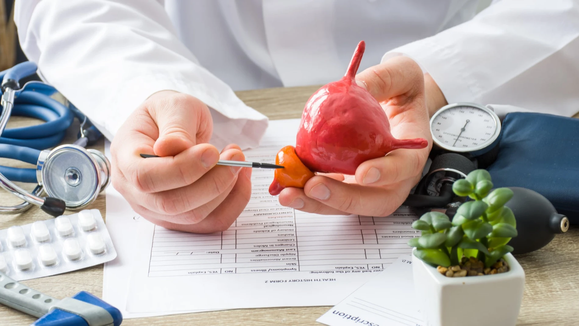 La hiperplasia benigna de próstata es un crecimiento benigno de la glándula prostática