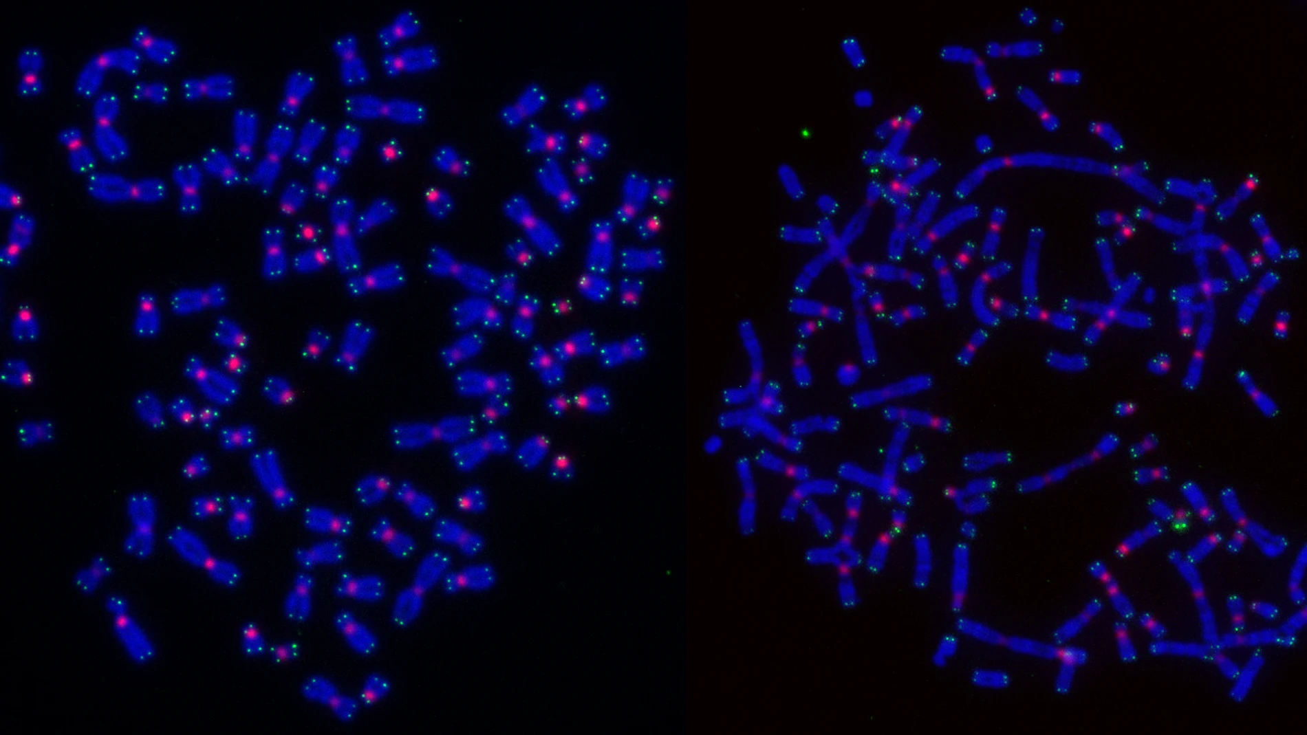 Cromosomas de células cancerosas con ADN teñido de azul, telómeros teñidos de verde y centrómeros teñidos de rosa