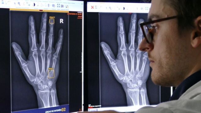 La Inteligencia Artificial realiza un diagnóstico casi inmediato y no se cansa 