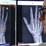 La Inteligencia Artificial realiza un diagnóstico casi inmediato y no se cansa 