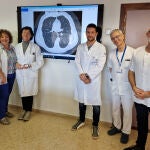 Equipo de neumología del hospital San Agustín de Avilés.