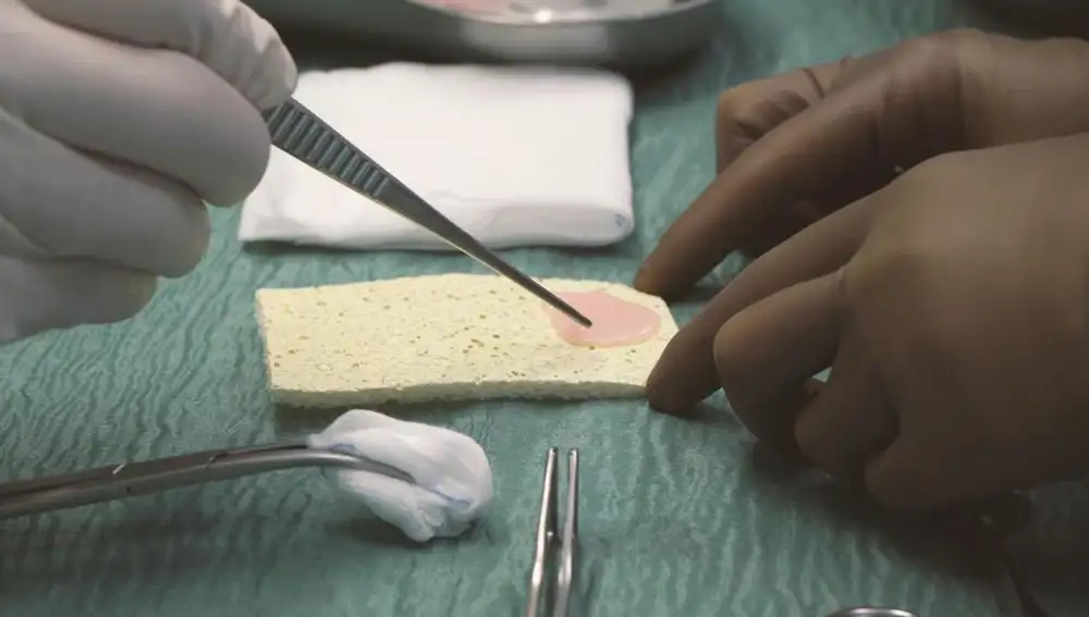 Primer plano de un parche de músculo cardíaco de color rosa cultivado en laboratorio sobre una esponja amarilla, que es recogida por un cirujano con guantes y pinzas