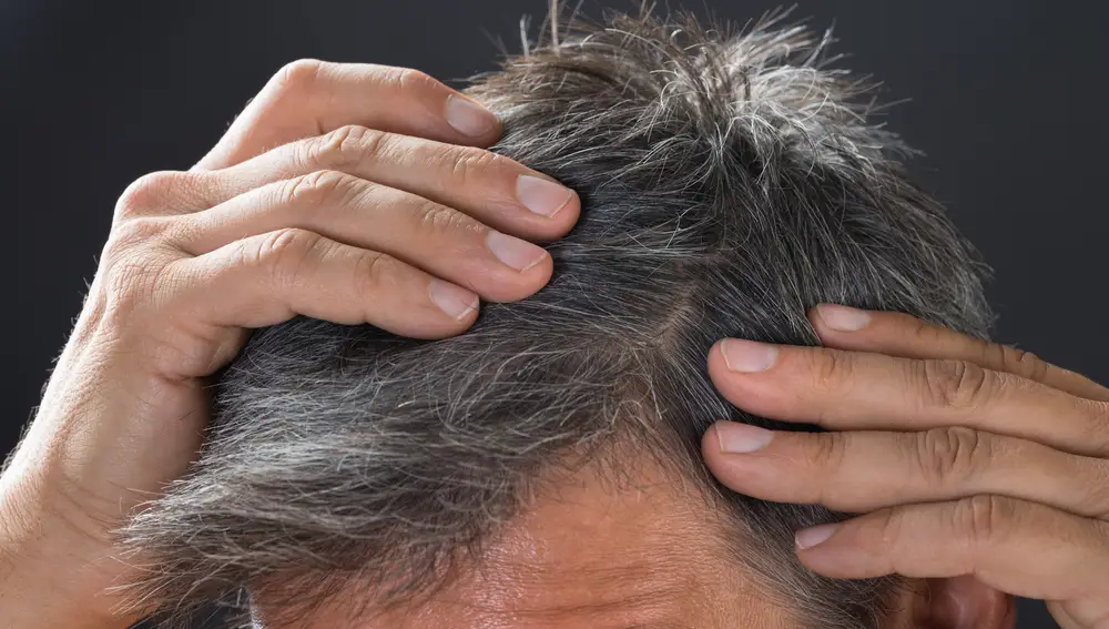 Las canas son un síntoma del envejecimiento, pero con ayuda de algunos superalimentos podemos conseguir la eterna juventud al ser una fuente de longevidad por nutrientes y beneficios