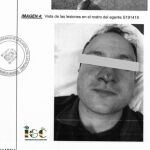 El resultado de la agresión a un agente de la Guardia Civil