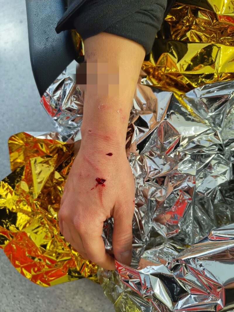 Las heridas de la policía durante el registro