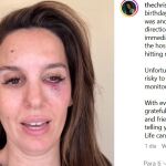 La voz de "Kim Possible" en Estados Unidos, disparada en el rostro: "A 2,5 cm de mi ojo derecho"