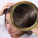 ¿Cada cuánto tiempo hay que lavarse el pelo si tienes caspa?