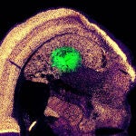 En verde las neuronas trasplantadas a partir de células dérmicas.