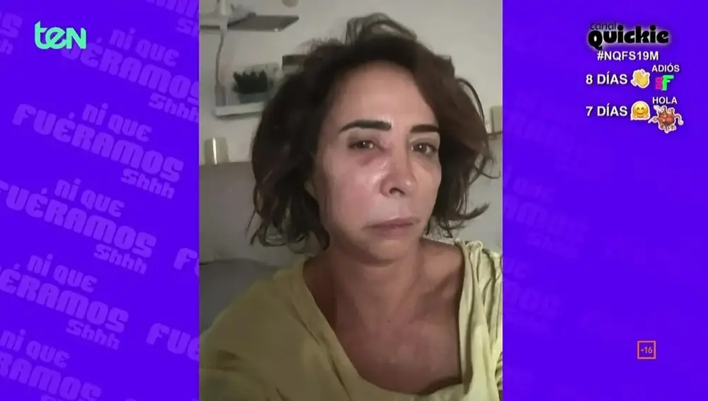 María Patiño con un flemón en 'Ni que fuéramos Shhh'