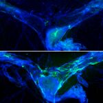 El envejecimiento compromete los vasos linfáticos (verdes) en un tejido llamado meninges (azul) que rodea el cerebro, lo que impide el drenaje de desechos del cerebro y afecta la función cognitiva. Investigadores de WashU Medicine fortalecieron la integridad de los vasos linfáticos (parte inferior) en ratones ancianos y encontraron mejoras en su memoria en comparación con ratones ancianos sin vasos linfáticos rejuvenecidos (parte superior). 