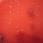 Streptococcus dysgalactiae 