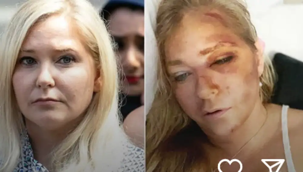 Virginia Giuffre, tras el accidente de tráfico
