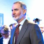 Las impactantes imágenes del Rey Felipe VI quemado por el sol tras un fin de semana en la nieve "sin protección"