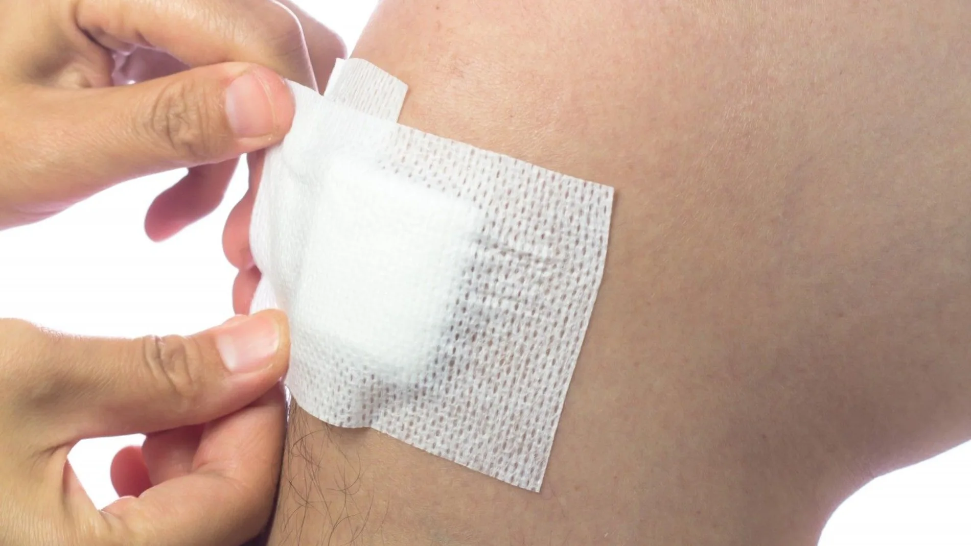 Herida de una artroscopia de rodilla después de la cirugía