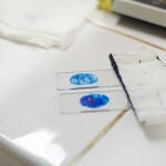 La principal forma de detectarla hoy en día es la muestra de esputo